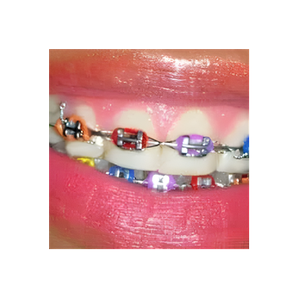 Dental at Lake Haven brand logo for dentalatlakehaven.com.au